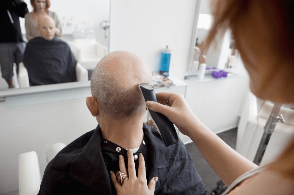 Hair Loss in Men