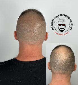 Bald Head Tattoo