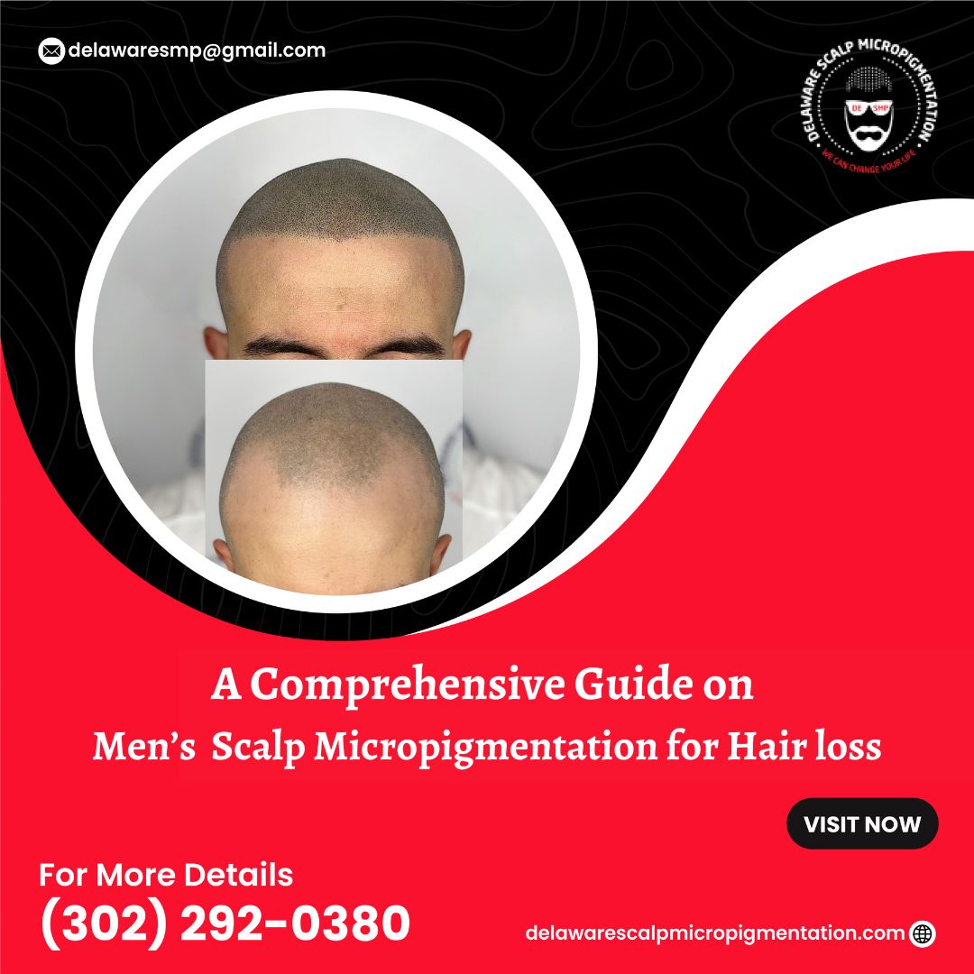Men’s Scalp Micropigmentation