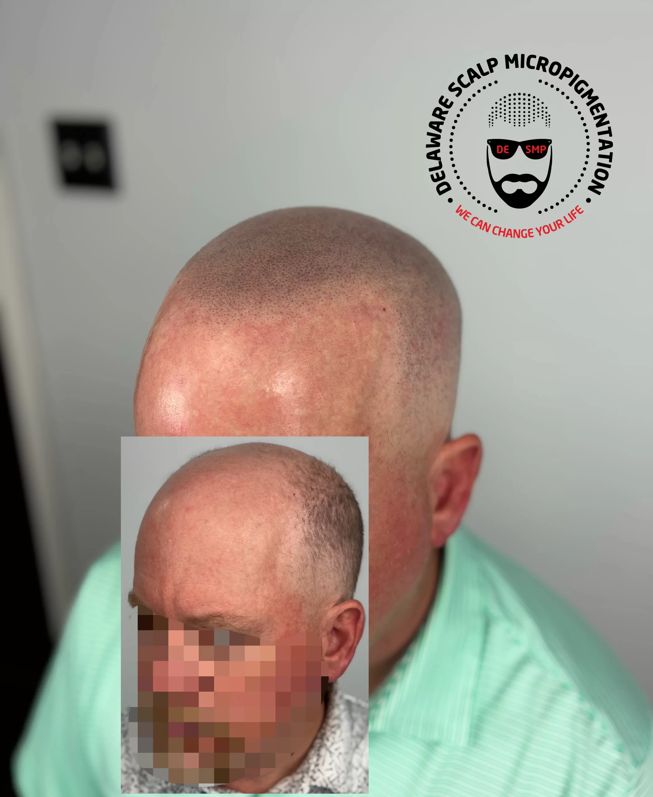 bqbc0iwmluri8d5q7ftf