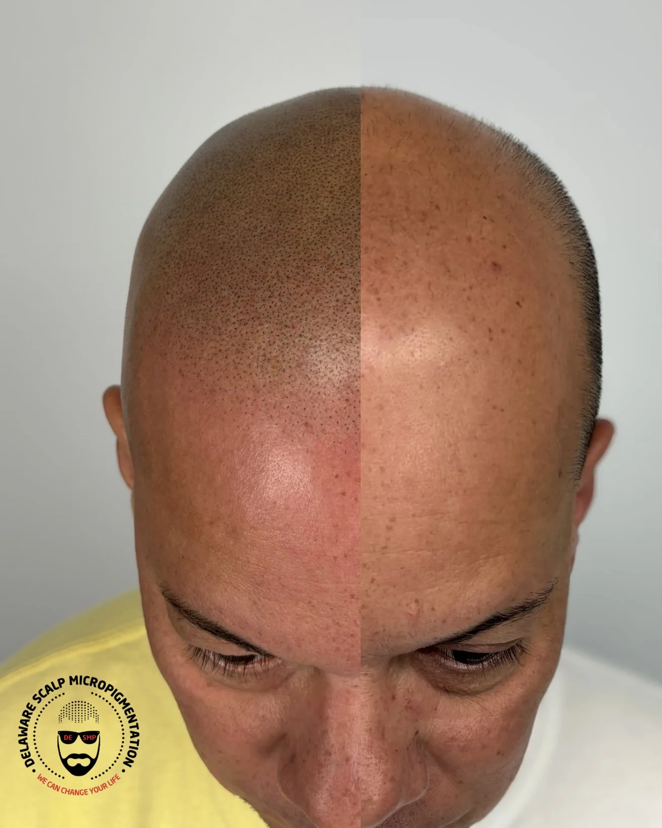 fjjfwzh0trqn2xwsygig