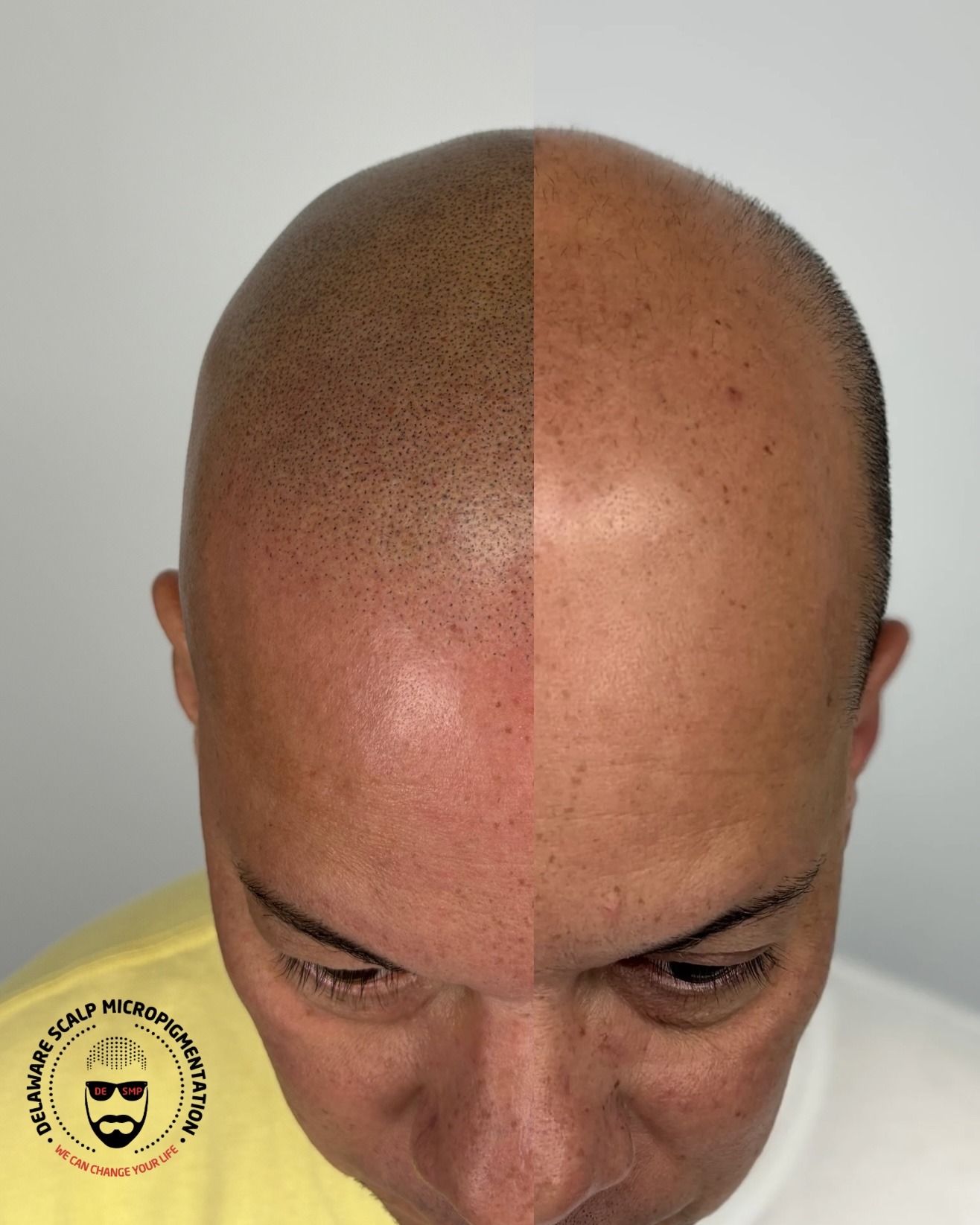 hair-tattoo-for-men-delaware-smp