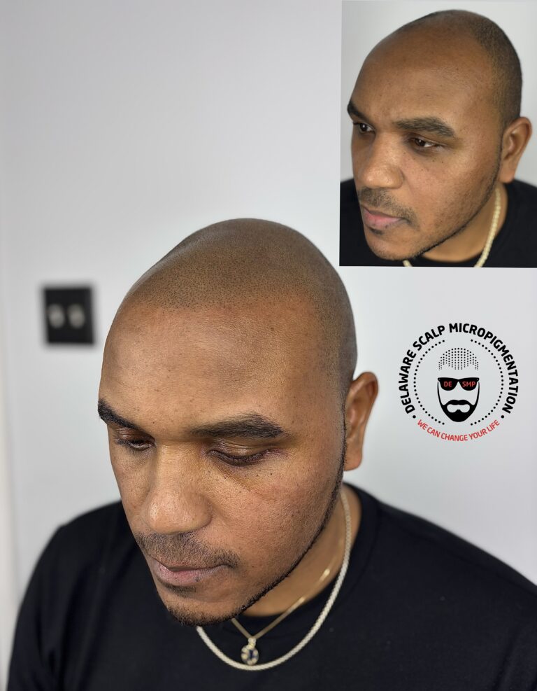 Natural SMP hairline restoration result at Delaware SMP