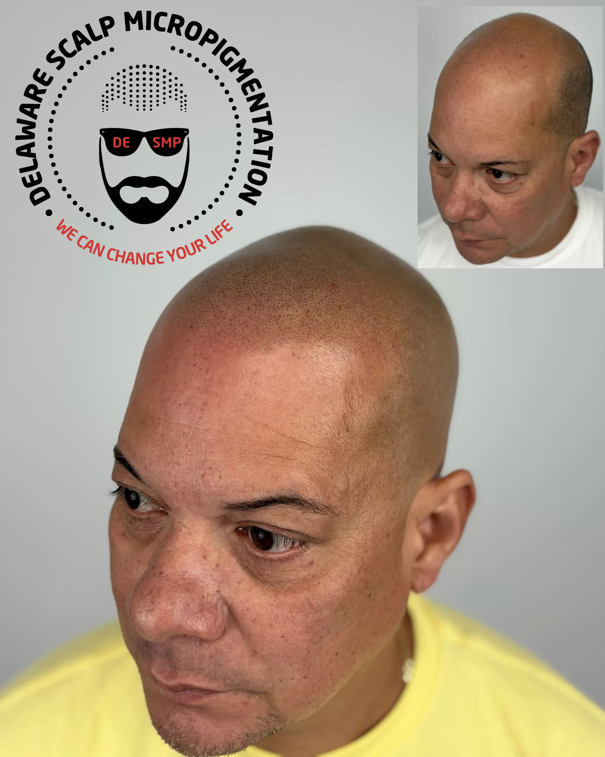 lzqvery4jqya2x4y9uff