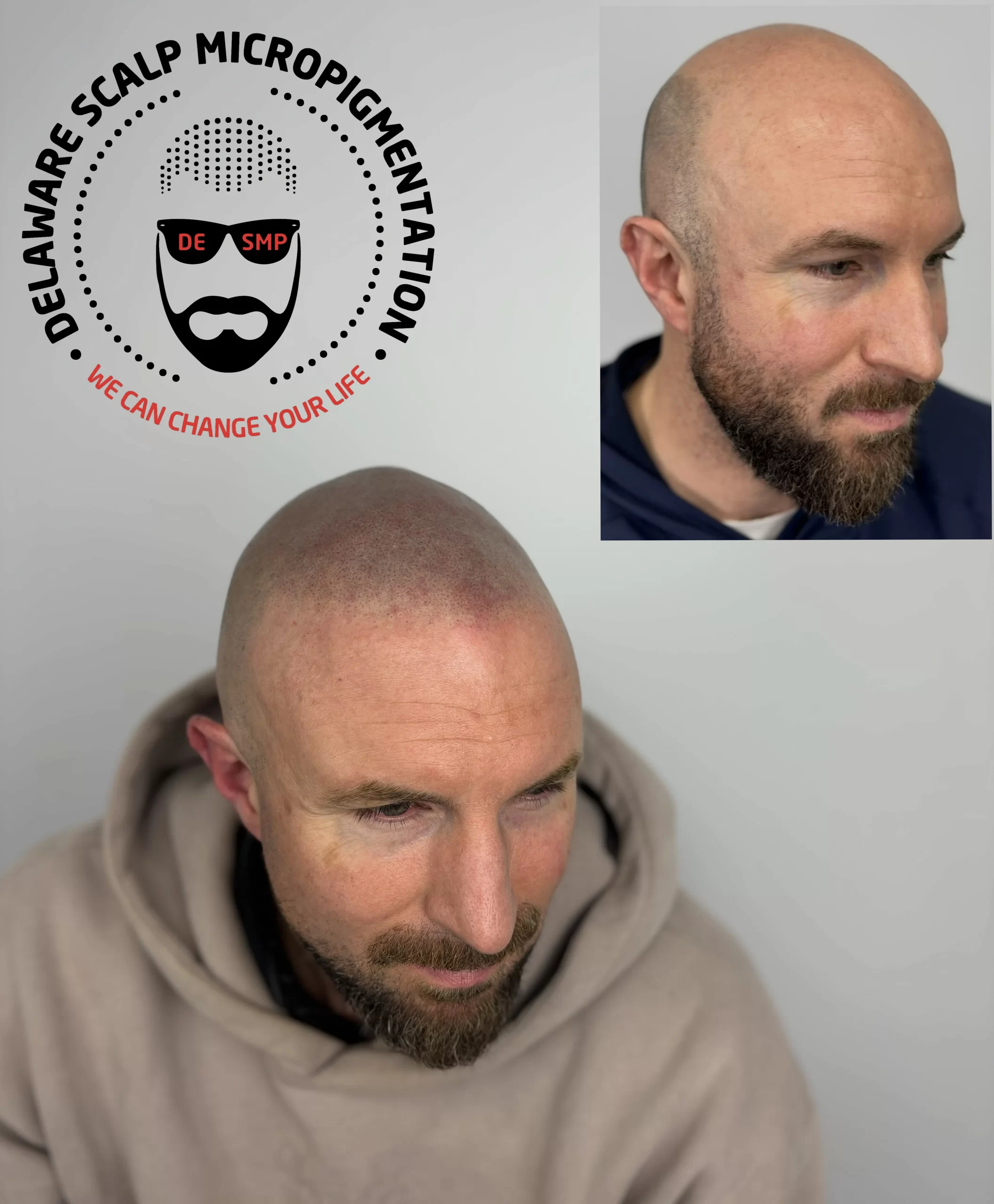 syyspgucztndrvyhc83g