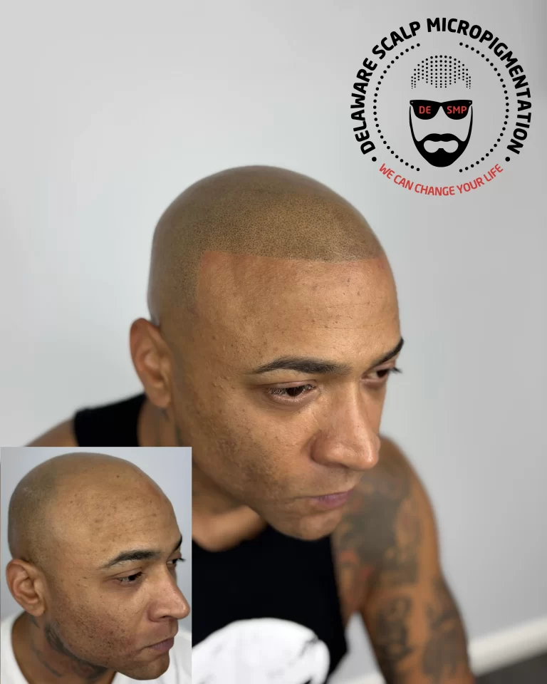 tnd6znbykniprnrggdvp