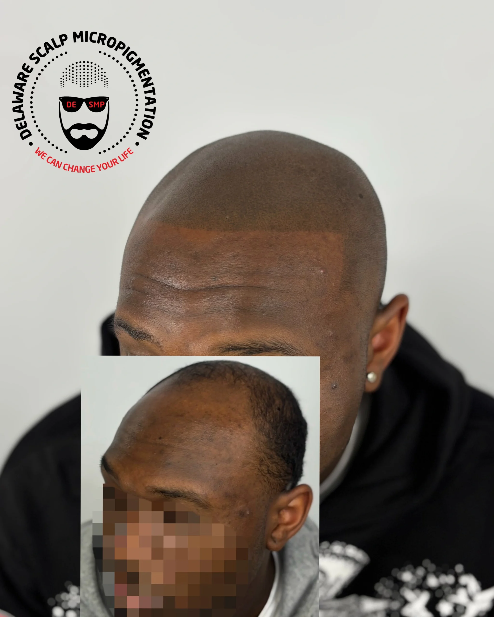 Best SMP Artist i the world is joey dots